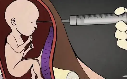 自己堕胎又开人流诊所,灾祸连连