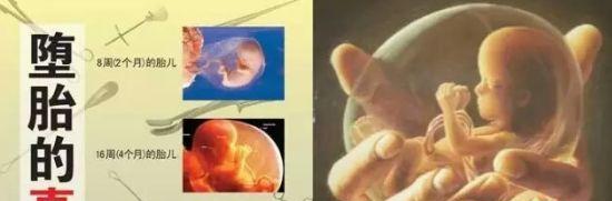 为什么要超度这些可怜的堕胎婴灵?