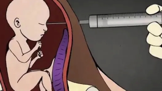 自己堕胎又开人流诊所，灾祸连连