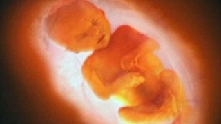 女性堕胎灵婴缠身 如何超度灵婴