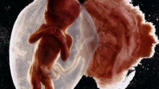 我闺蜜人流后一年身体都很差，经常要跑医院